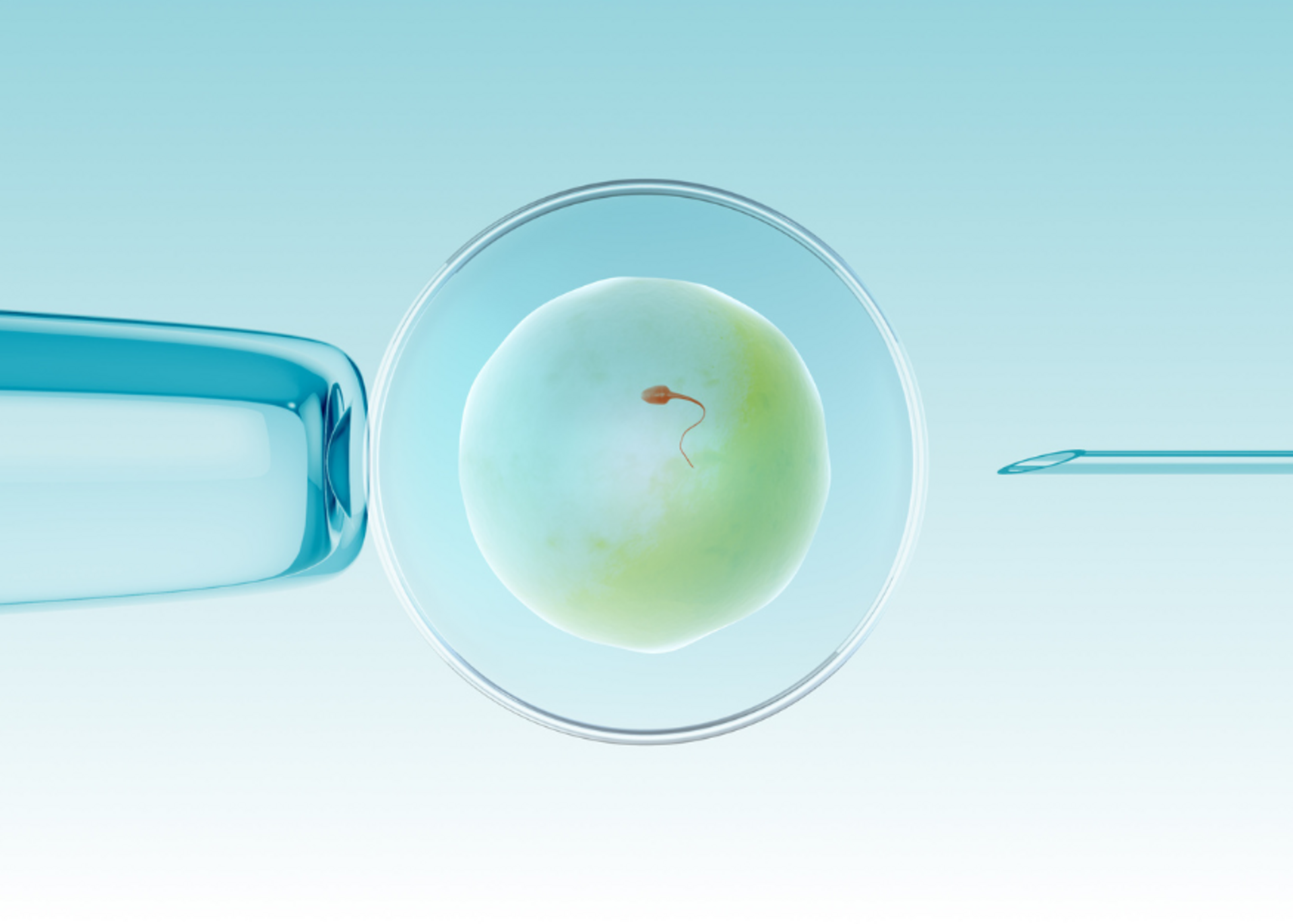 IVF (In-Vitro Fertilization)