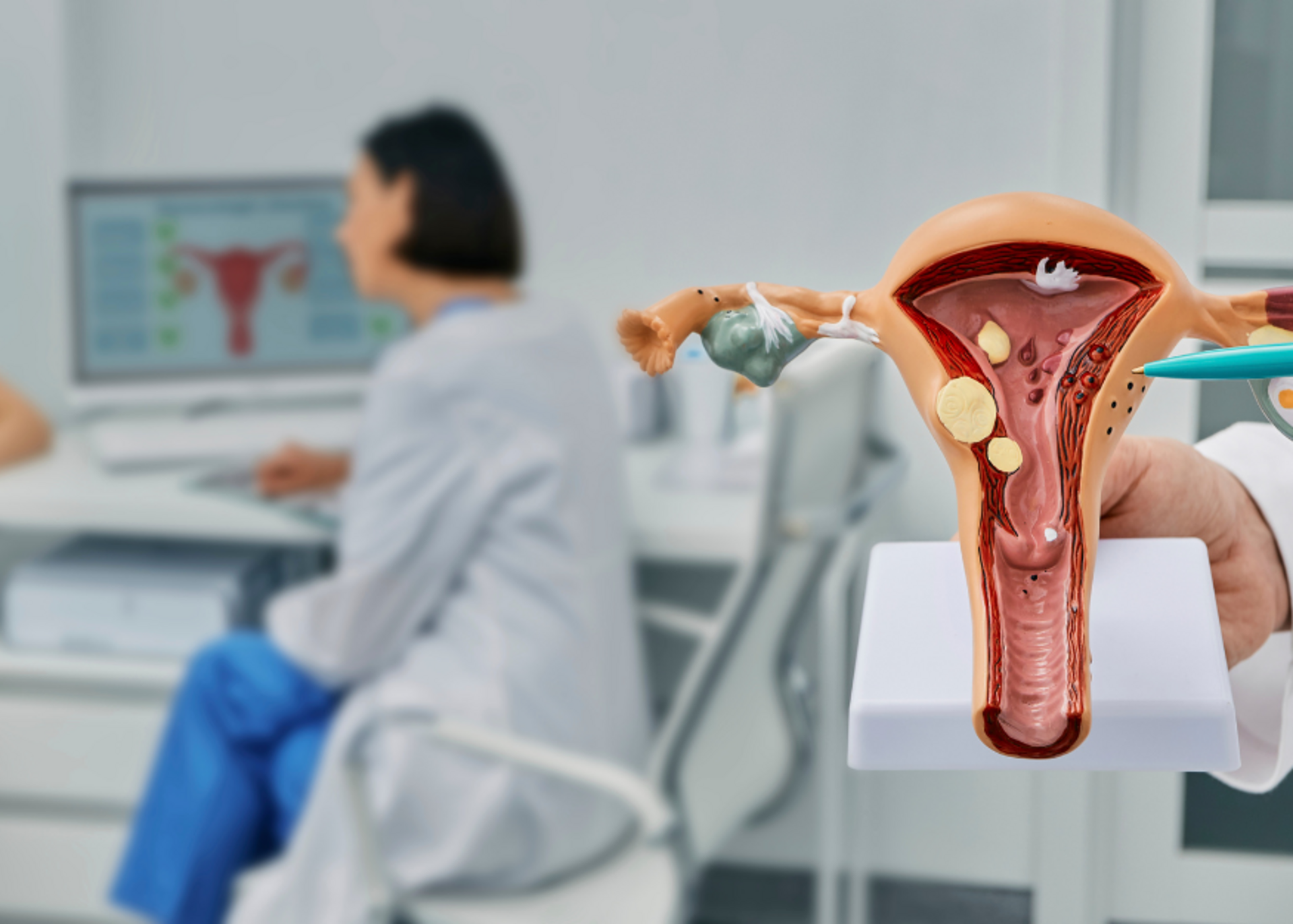 Endometriosis Treatment