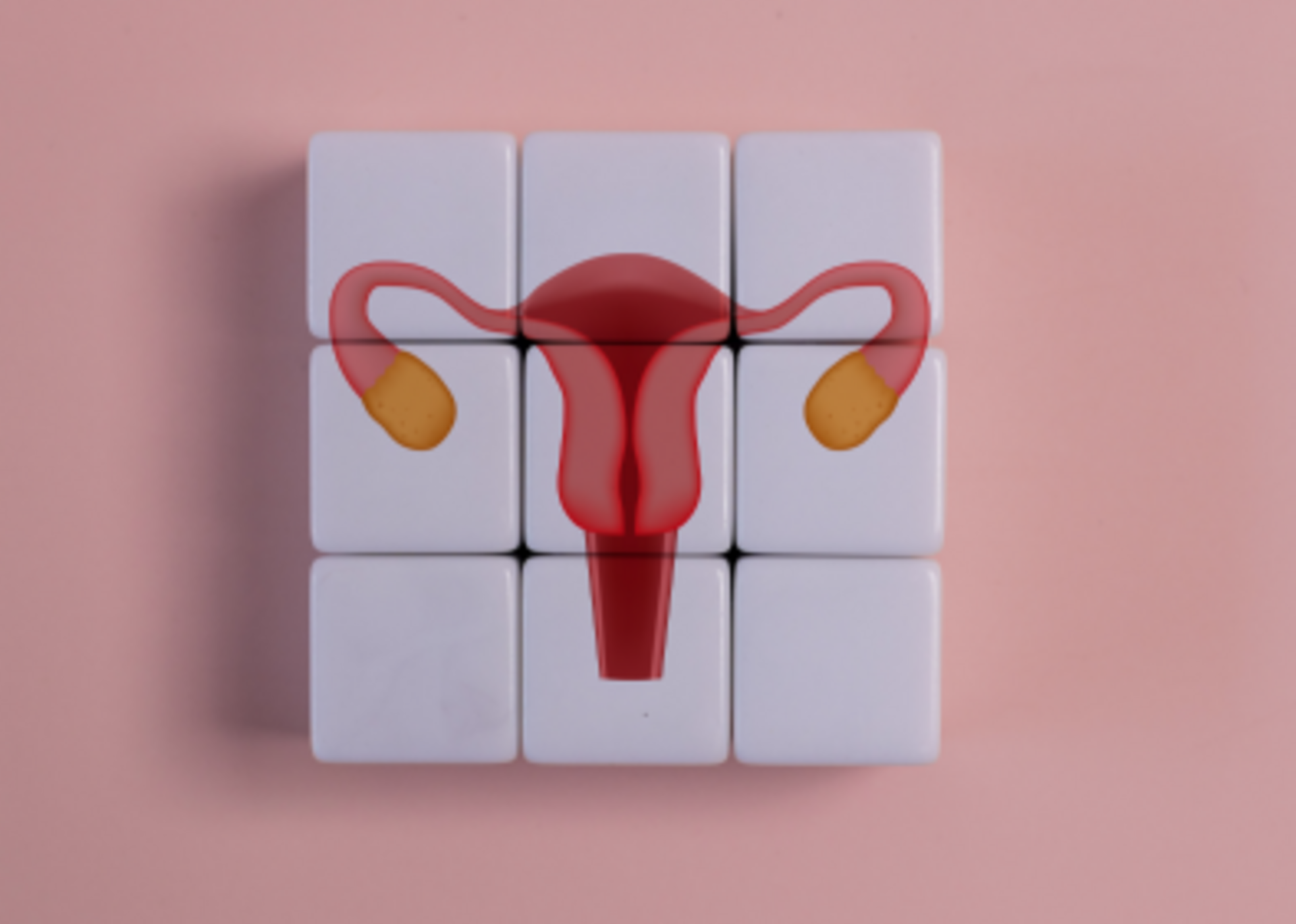 PCOS/PCOD Management